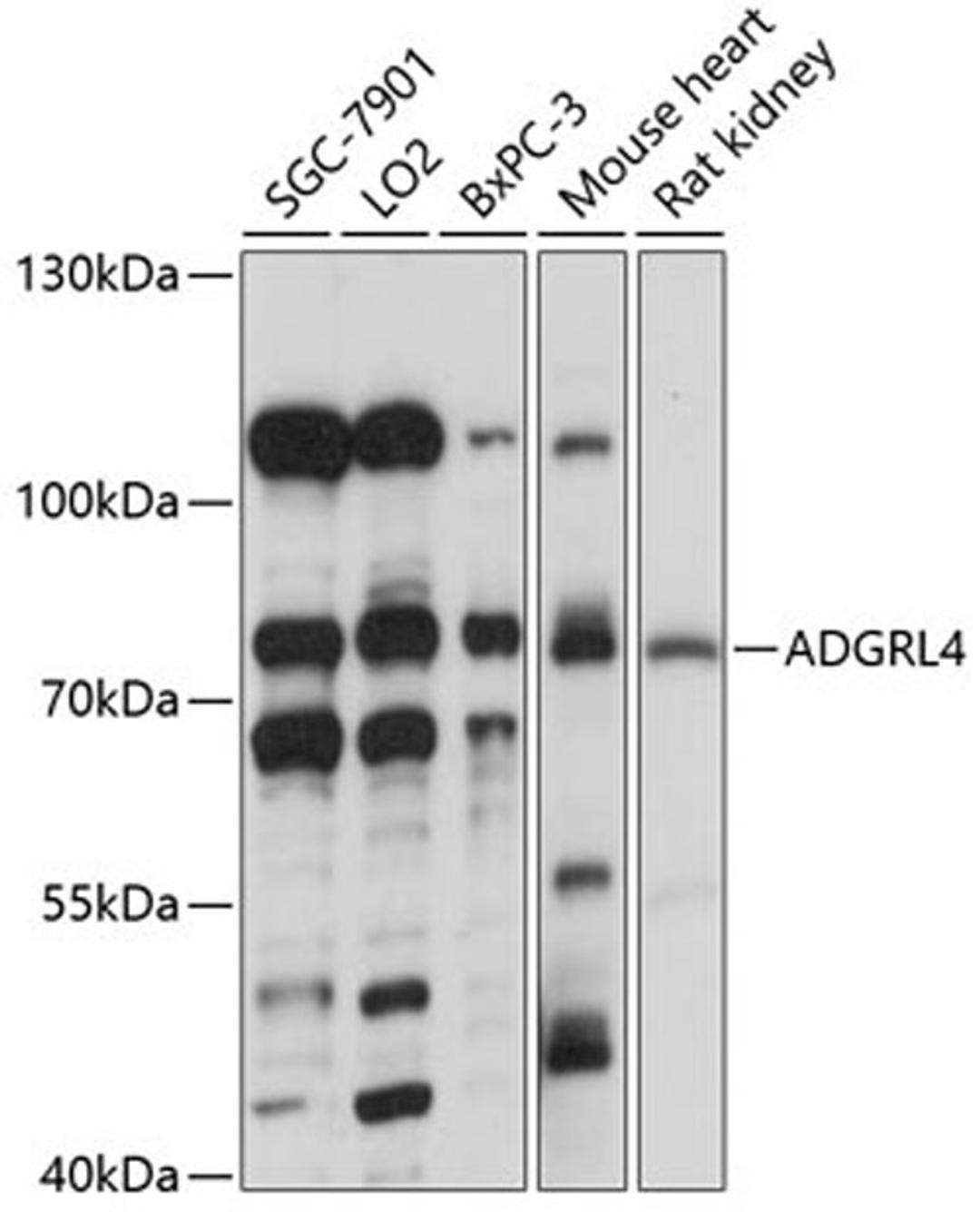 Western blot - ADGRL4 antibody (A14595)