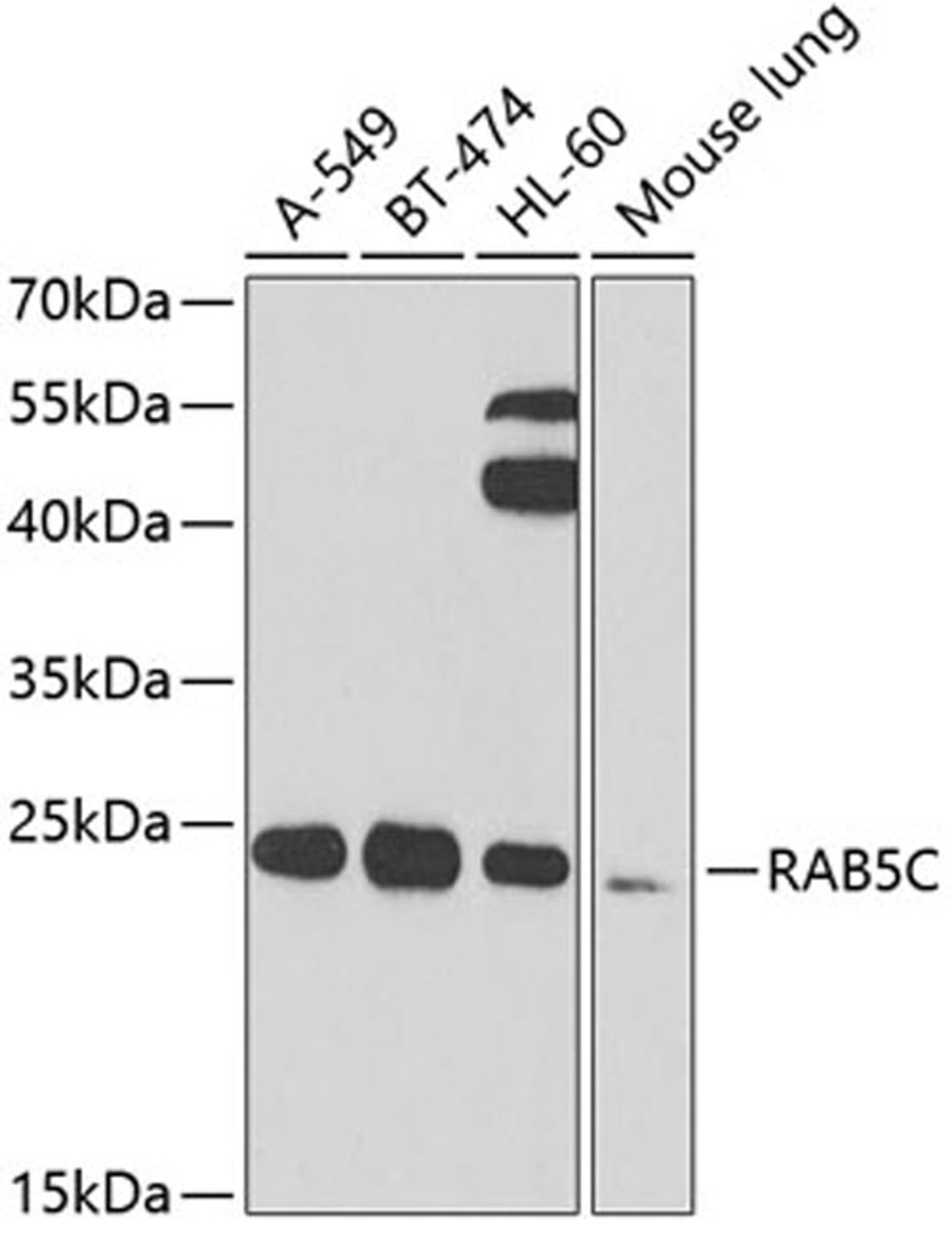 Western blot - RAB5C antibody (A7342)