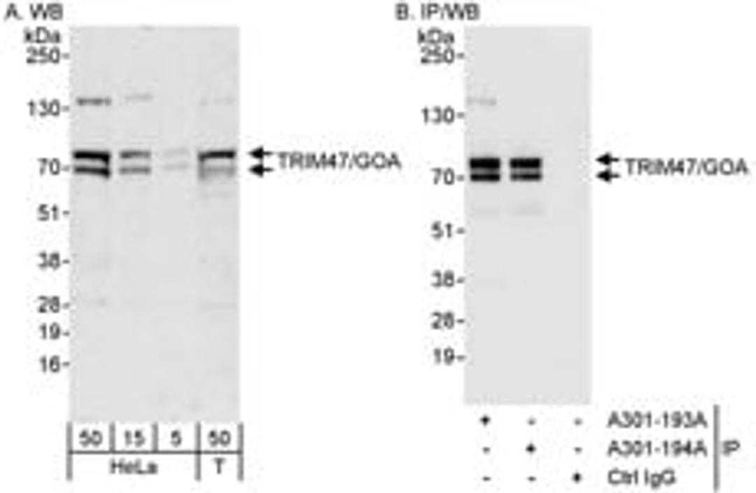 Detection of human TRIM47/GOA by western blot and immunoprecipitation.