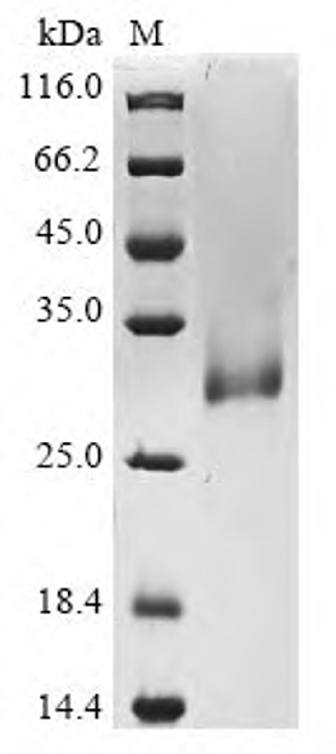 (Tris-Glycine gel) Discontinuous SDS-PAGE (reduced) with 5% enrichment gel and 15% separation gel.