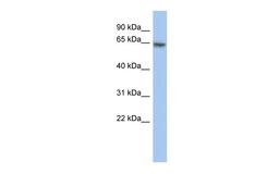 Antibody used in WB on Human HT1080 at 0.2-1 ug/ml.