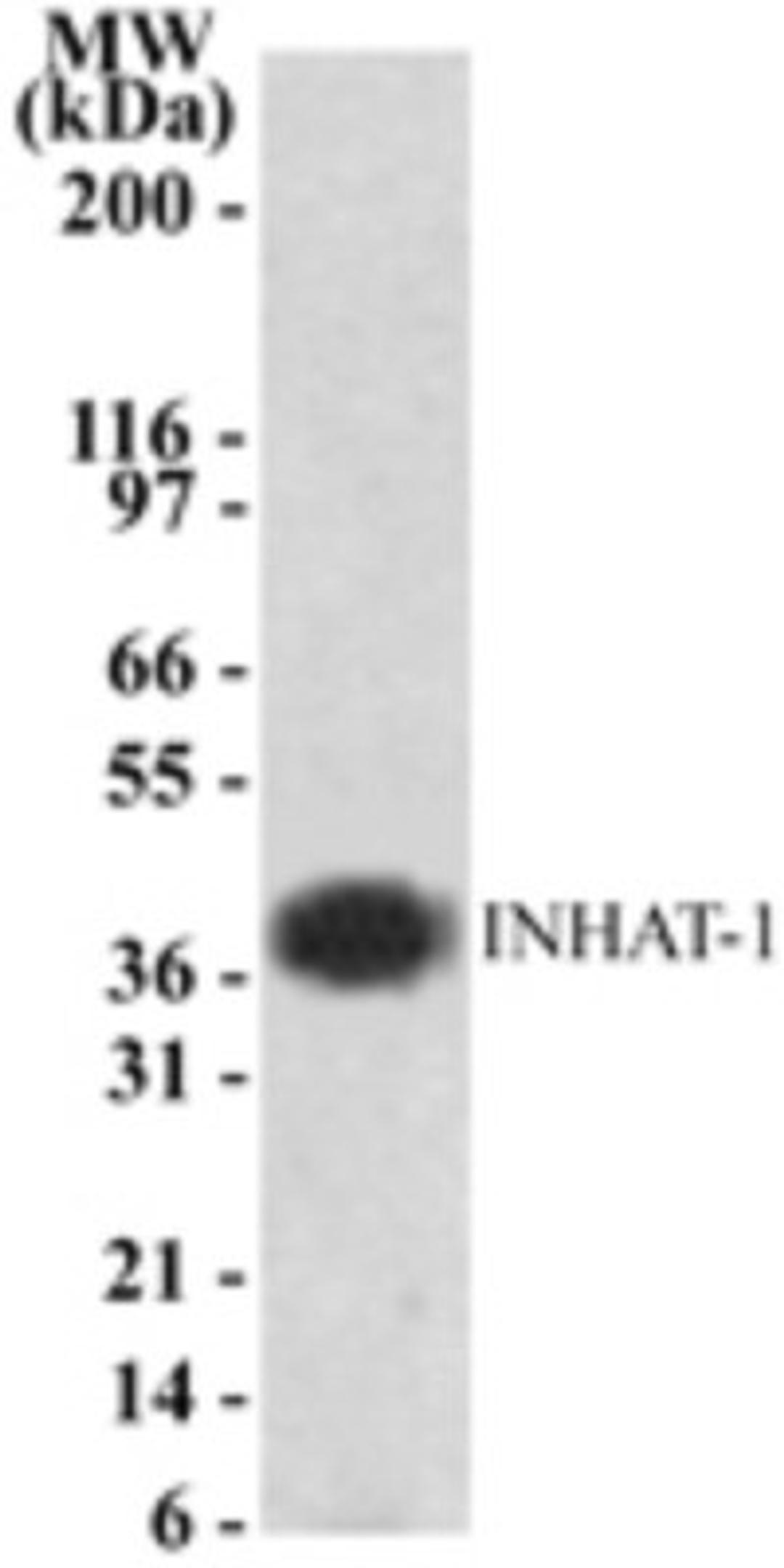 Western Blot: INHAT-1 Antibody [NB100-56353] - analysis of INHAT-1 using this antibody.