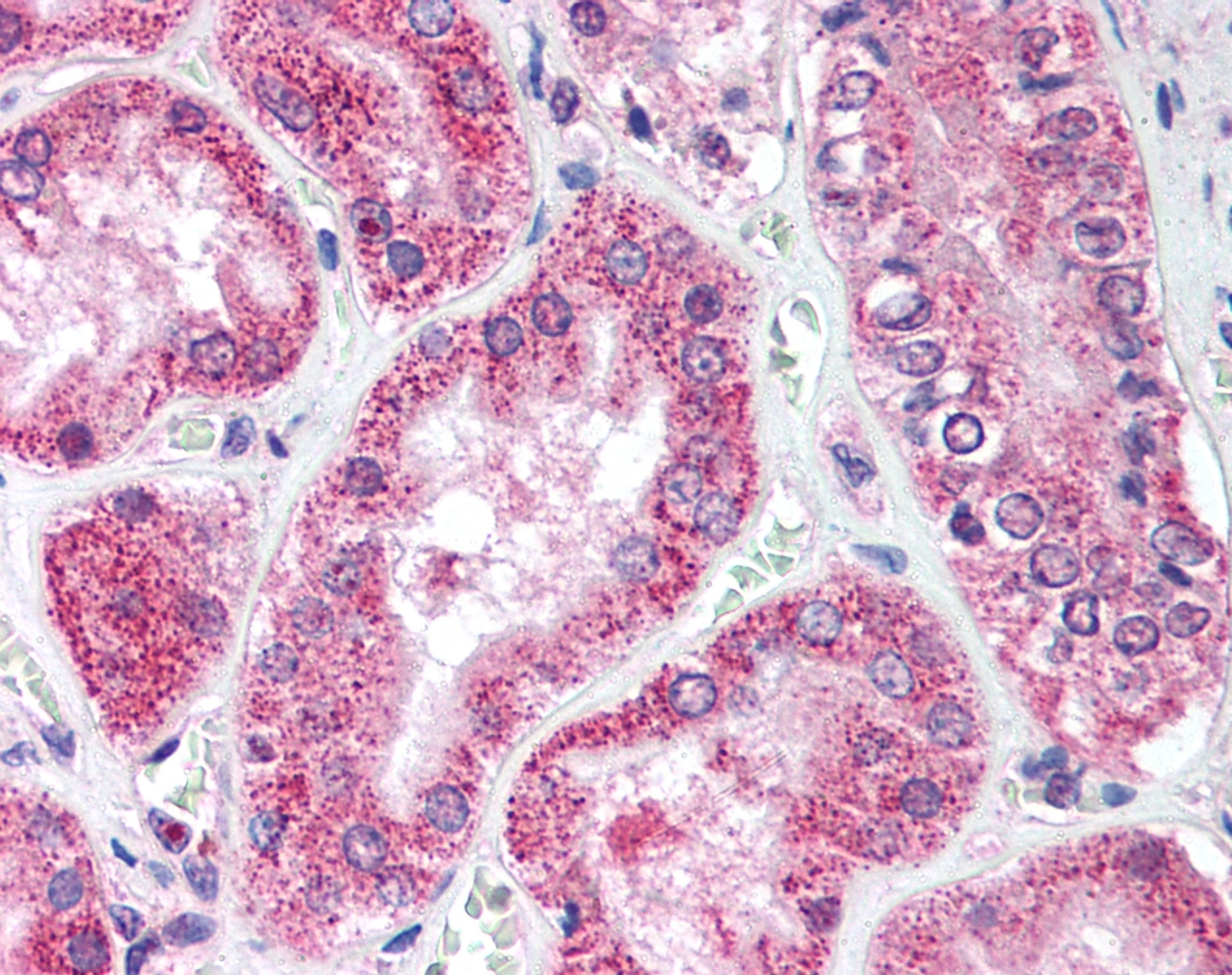 Staining of formalin fixed, paraffin embedded human kidney with Rabbit anti Human ULK1 (AHP2214)