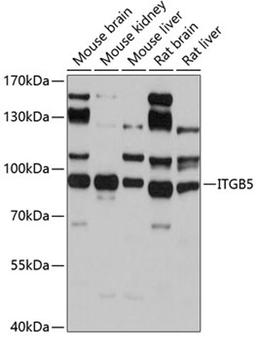 Western blot - ITGB5 antibody (A2497)