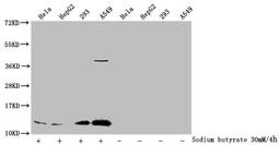 Western Blot. Detected samples: Hela whole cell lysate, HepG2 whole cell lysate, 293 whole cell lysate, A549 whole cell lysate; Untreated (-) or treated (+) with 30mM sodium butyrate for 4h. All lanes: HIST1H4A antibody at 1:1000. Secondary. Goat polyclonal to rabbit IgG at 1/40000 dilution. Predicted band size: 12 kDa. Observed band size: 12 kDa