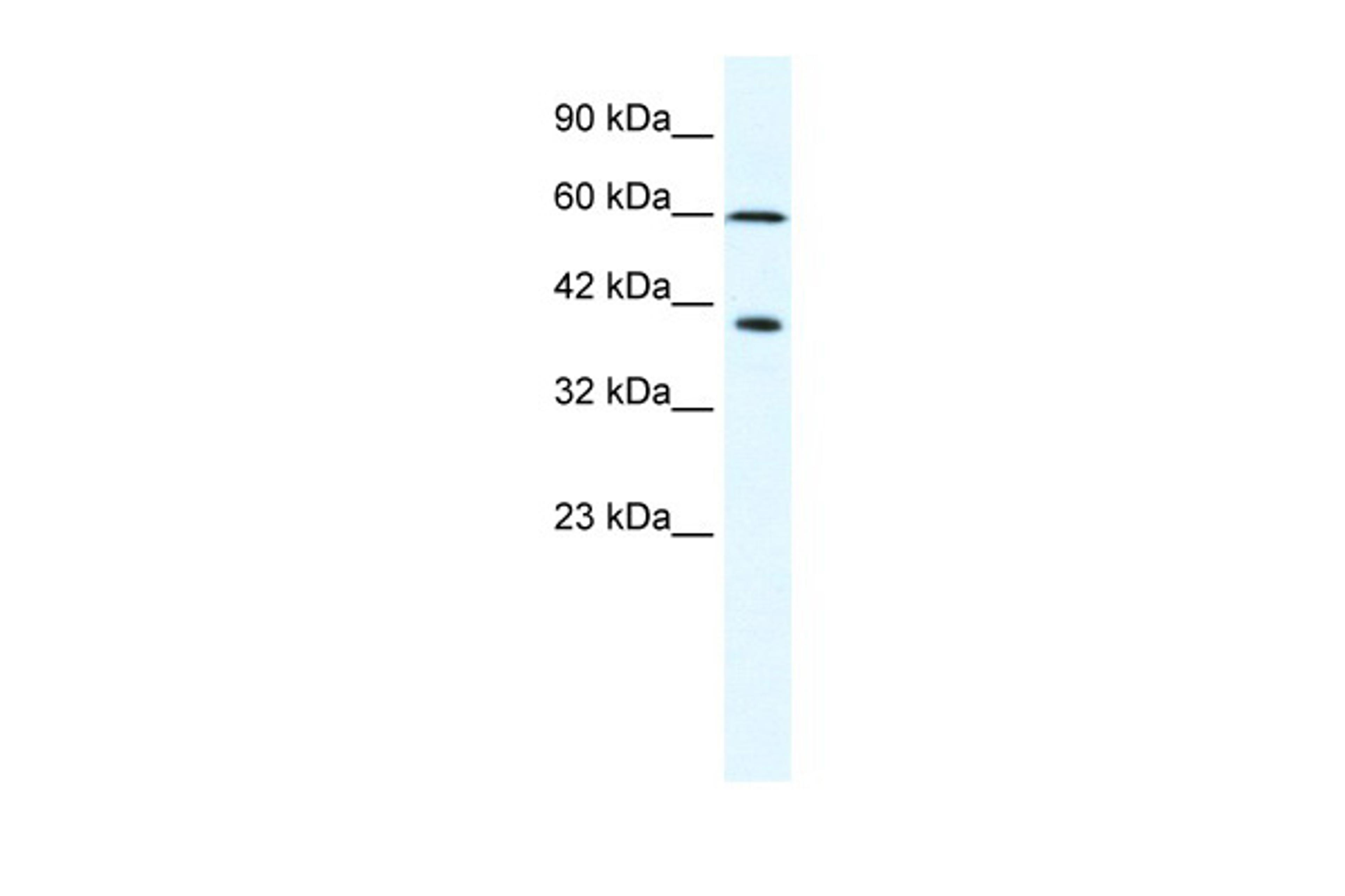 Antibody used in WB on Human Daudi cells at 2.5 ug/ml.