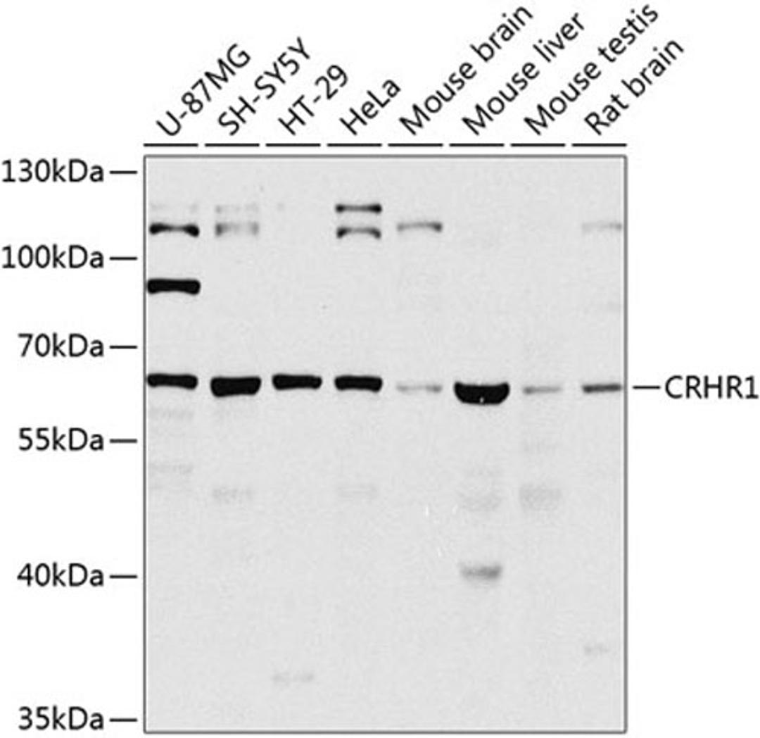 Western blot - CRHR1 antibody (A8409)