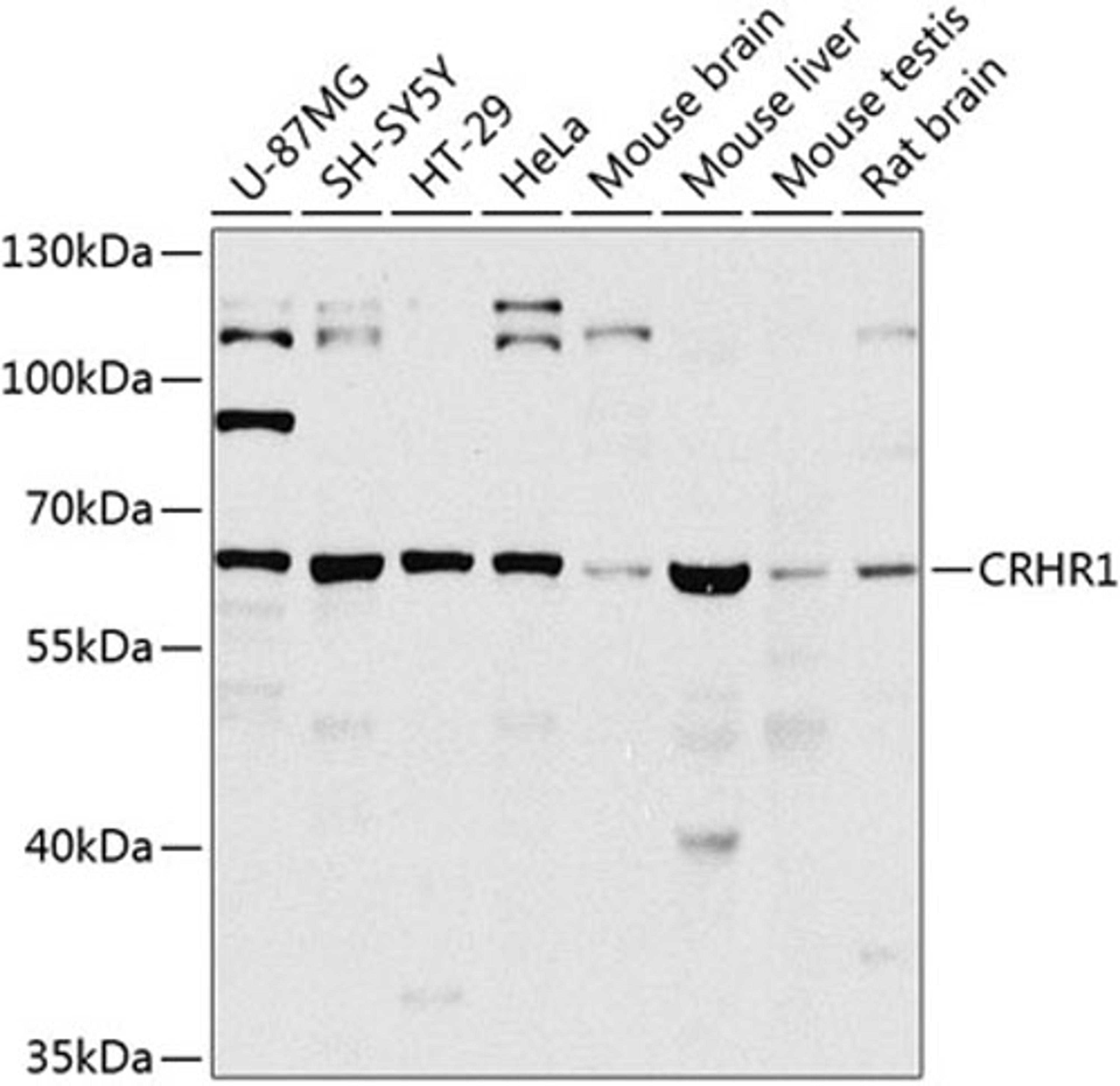 Western blot - CRHR1 antibody (A8409)