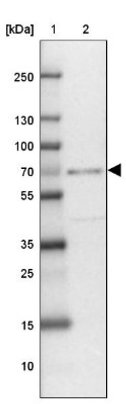 Western Blot: ZNF432 Antibody [NBP2-31813] - Lane 1: Marker [kDa] 250, 130, 100, 70, 55, 35, 25, 15, 10<br/>Lane 2: Liver