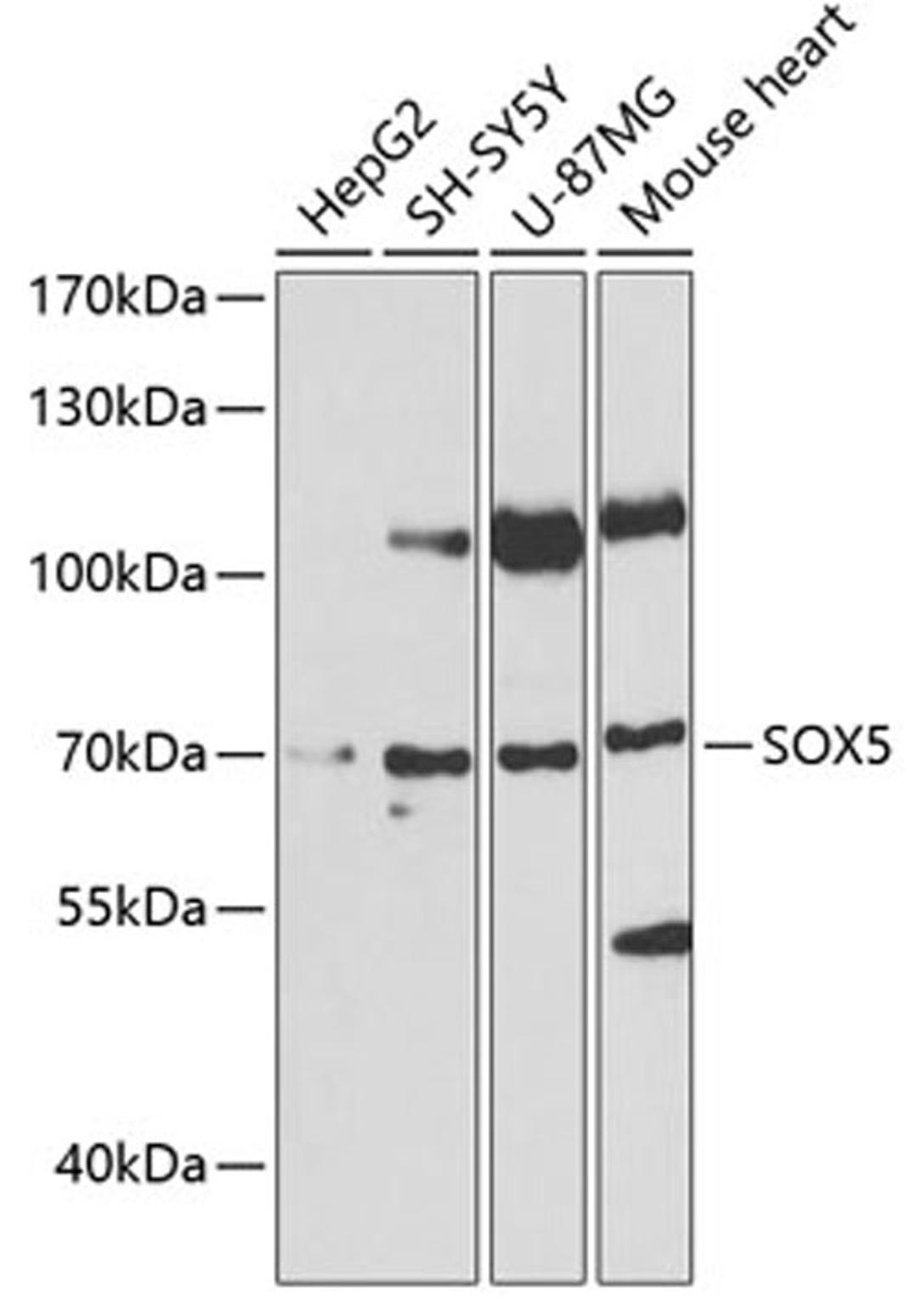 Western blot - SOX5 antibody (A6985)