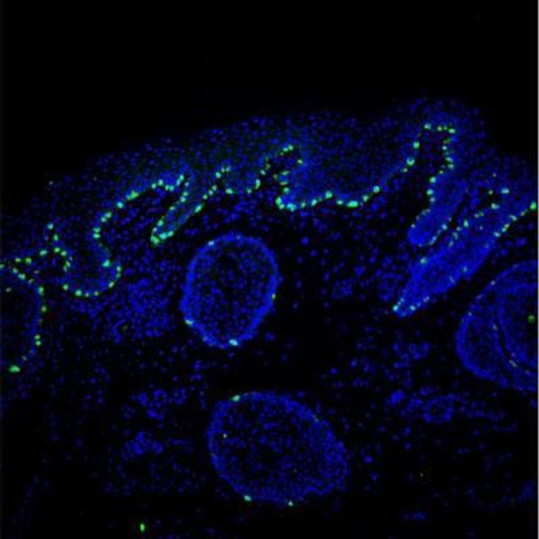 Immunocytochemistry/Immunofluorescence: MART-1 / Melan-A Antibody (A19-P) [NBP1-30151] - Staining of human adult facial skin using NBP1-30151 at a dilution of 1:200. Image provided by Dr. H. Locher of Leiden University Medical Center.