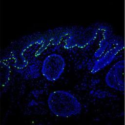 Immunocytochemistry/Immunofluorescence: MART-1 / Melan-A Antibody (A19-P) [NBP1-30151] - Staining of human adult facial skin using NBP1-30151 at a dilution of 1:200. Image provided by Dr. H. Locher of Leiden University Medical Center.