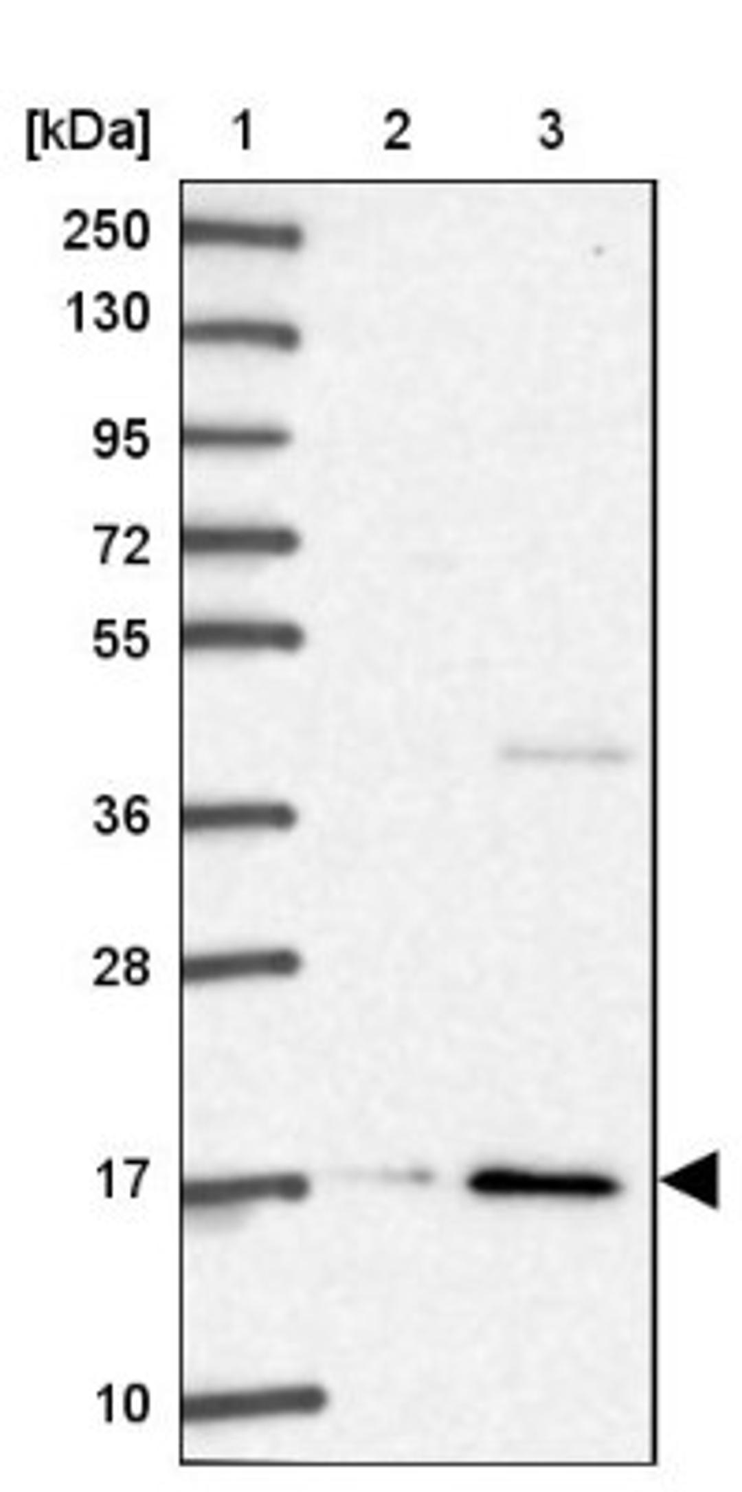 Western Blot: RPL28 Antibody [NBP2-13254] - Lane 1: Marker [kDa] 250, 130, 95, 72, 55, 36, 28, 17, 10<br/>Lane 2: Human cell line RT-4<br/>Lane 3: Human cell line U-251MG sp