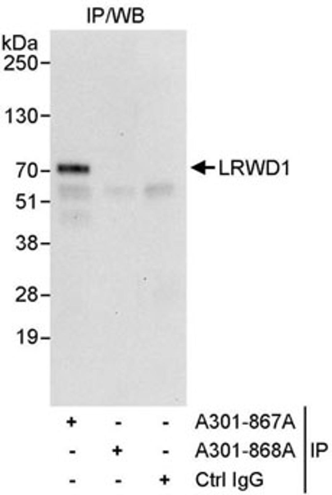 Detection of human LRWD1 by western blot of immunoprecipitates.