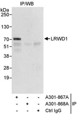 Detection of human LRWD1 by western blot of immunoprecipitates.