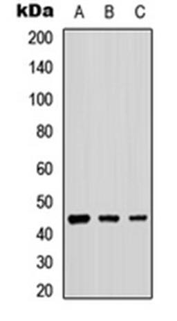 Western blot analysis of A549 (Lane 1), NS-1 (Lane 2), PC12 (Lane 3) whole cell lysates using B4GALT2 antibody