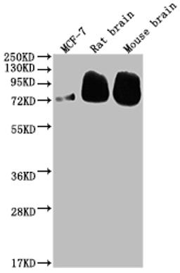 Western Blot. Positive WB detected in: MCF-7 whole cell lysate, Rat brain tissue, Mouse brain tissue. All lanes: BACE1 antibody at 1:2000. Secondary. Goat polyclonal to rabbit IgG at 1/50000 dilution. Predicted band size: 56, 53, 52, 49, 46, 43 kDa. Observed band size: 72 kDa. 
