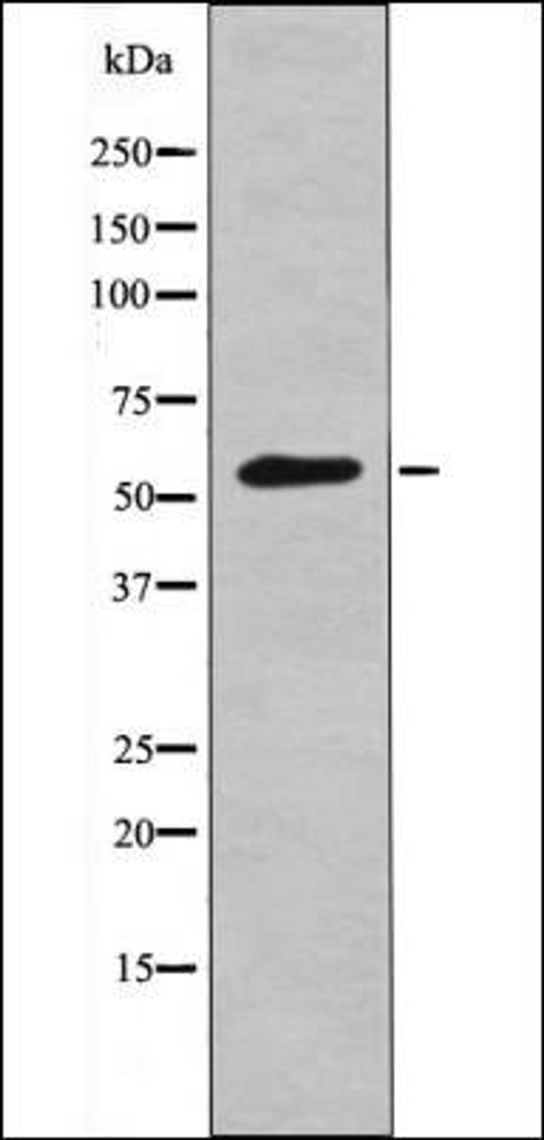 Western blot analysis of Mouse braintissue lysates using FGR -Phospho-Tyr412- antibody