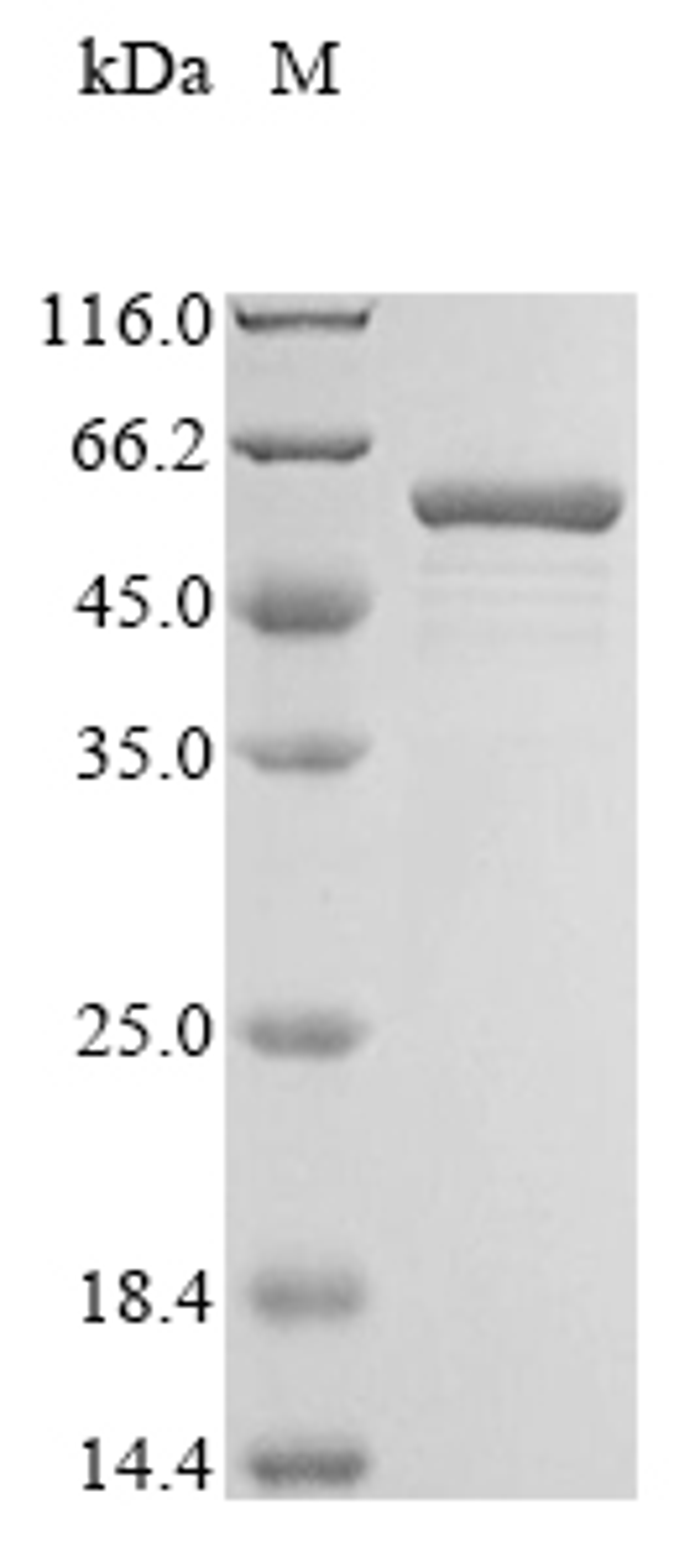 (Tris-Glycine gel) Discontinuous SDS-PAGE (reduced) with 5% enrichment gel and 15% separation gel.