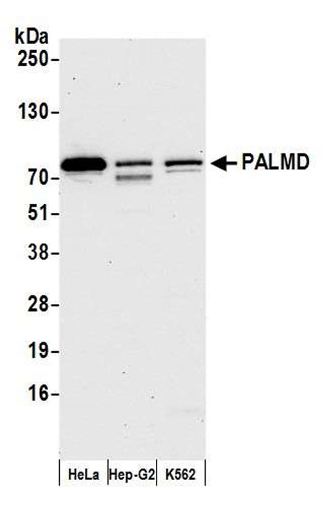 Detection of human PALMD by WB.