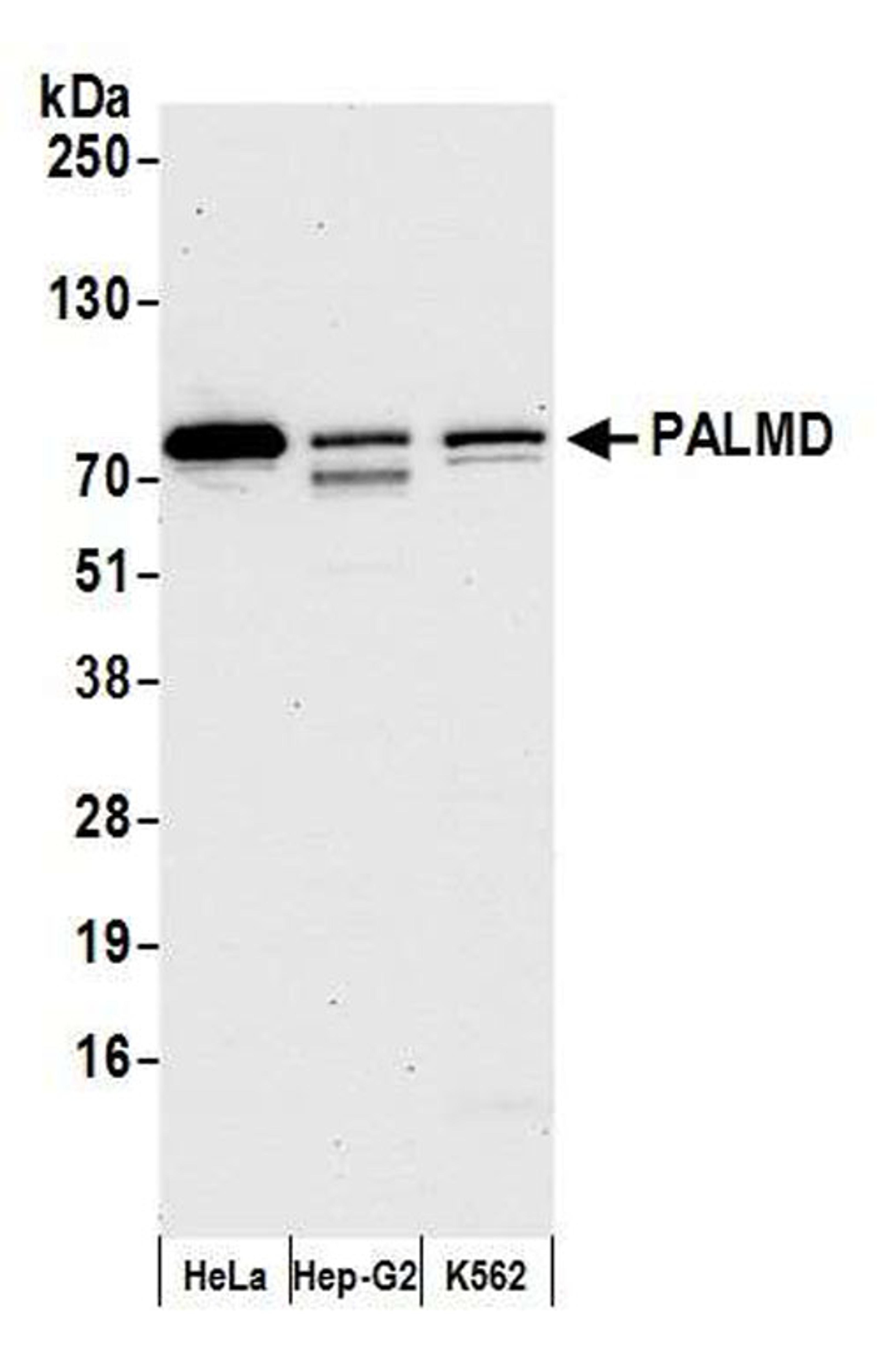 Detection of human PALMD by WB.