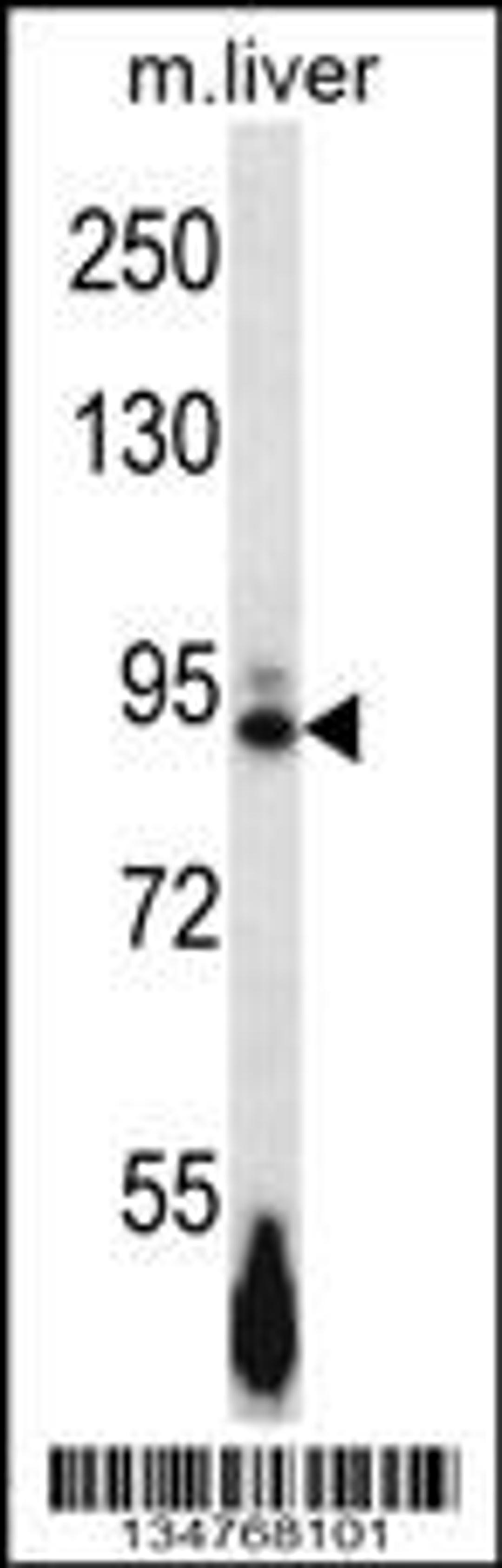 Western blot analysis in mouse liver tissue lysates (35ug/lane).