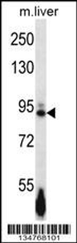 Western blot analysis in mouse liver tissue lysates (35ug/lane).