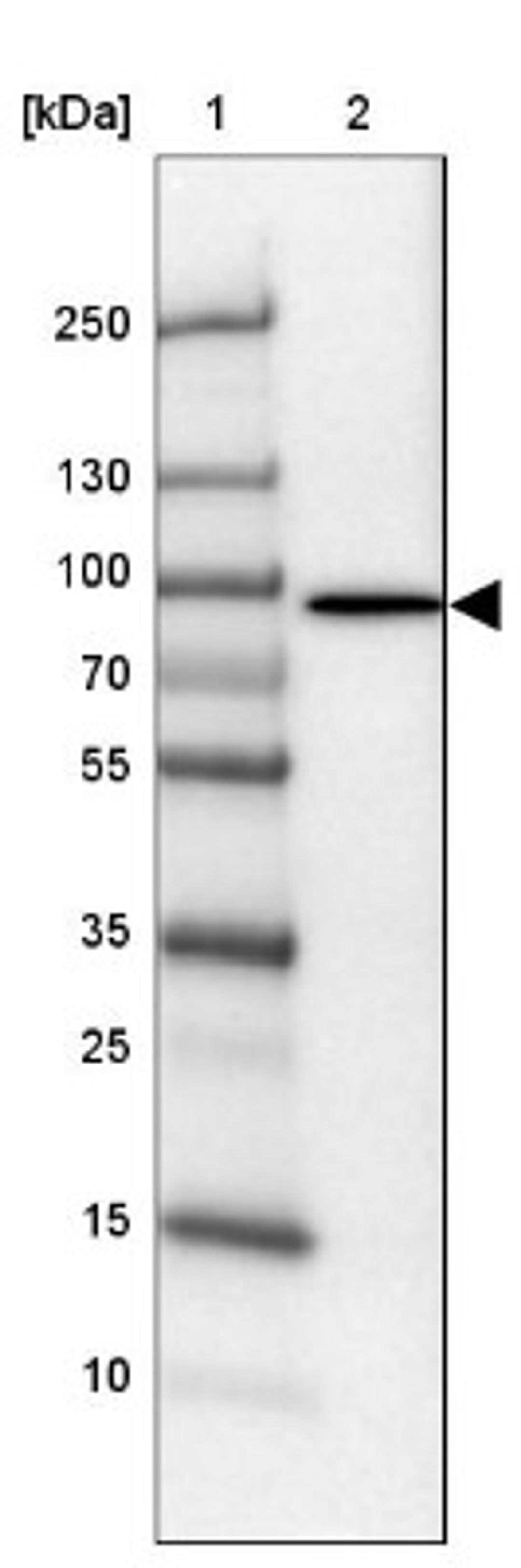 Western Blot: Phospholipase C delta 1 Antibody [NBP1-87552] - Lane 1: Marker [kDa] 250, 130, 100, 70, 55, 35, 25, 15, 10<br/>Lane 2: Testis