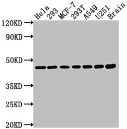 Western Blot. Positive WB detected in: Hela whole cell lysate, 293 whole cell lysate, MCF-7 whole cell lysate, 293T whole cell lysate, A549 whole cell lysate, U251 whole cell lysate, Rat brain tissue. All lanes: MAP2K1 antibody at 1:2000. Secondary. Goat polyclonal to rabbit IgG at 1/50000 dilution. Predicted band size: 44, 41 kDa. Observed band size: 44 kDa.