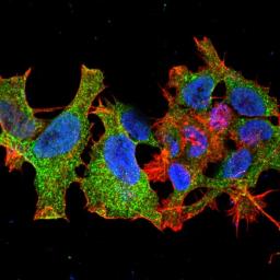 Immunofluorescence analysis of neuroblastoma cell line sk-n-be using Malin antibody