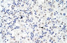 Antibody used in IHC on Human Liver.