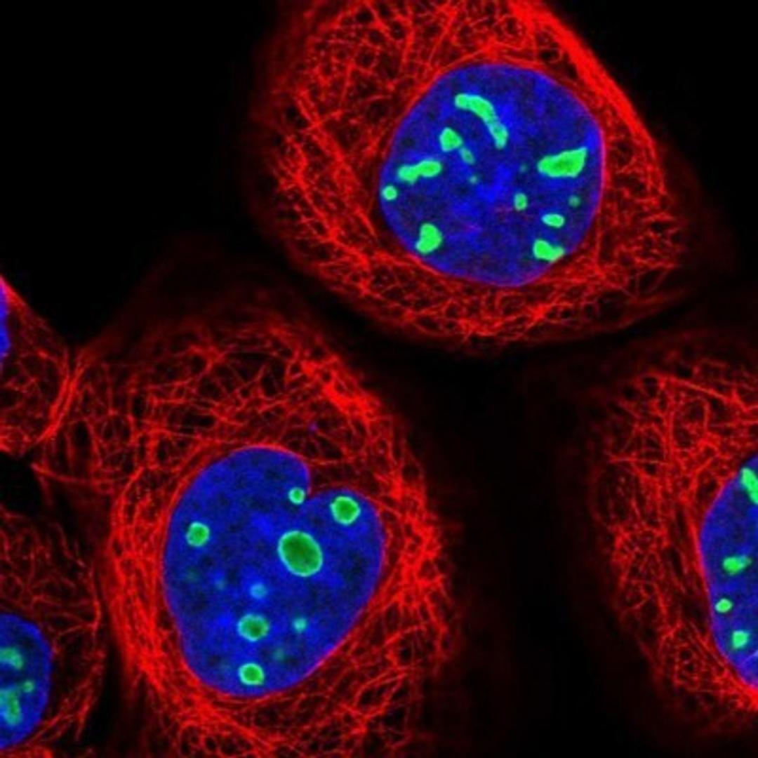 Immunocytochemistry/Immunofluorescence: EBNA1BP2 Antibody [NBP1-84022] - Staining of human cell line A-431 shows positivity in nucleoli.