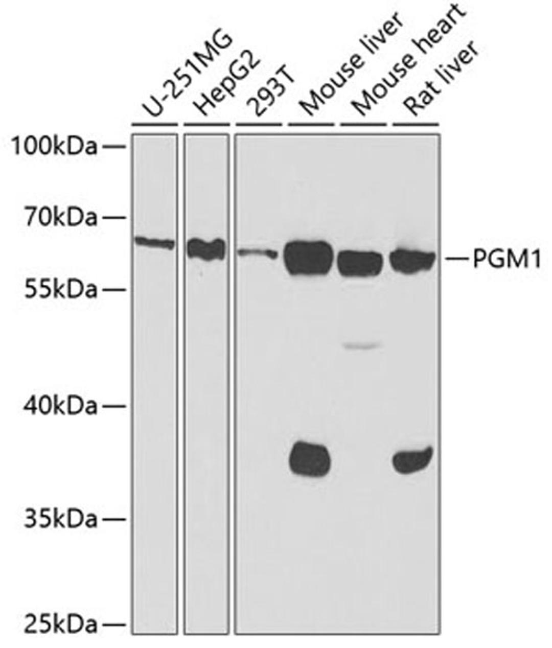 Western blot - PGM1 antibody (A6303)