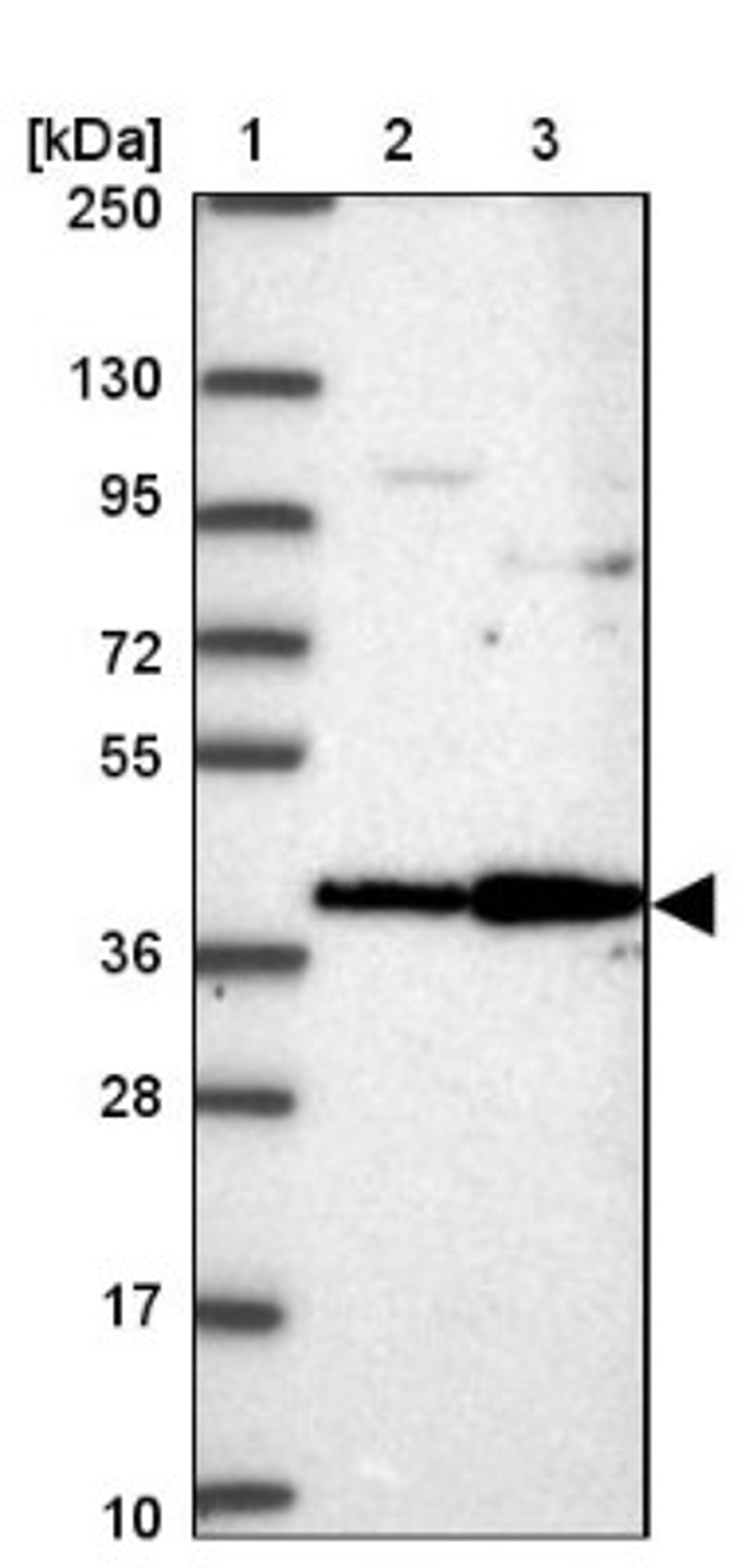 Western Blot: ANKRD33 Antibody [NBP2-32400] - Lane 1: Marker [kDa] 250, 130, 95, 72, 55, 36, 28, 17, 10<br/>Lane 2: Human cell line RT-4<br/>Lane 3: Human cell line U-251MG sp