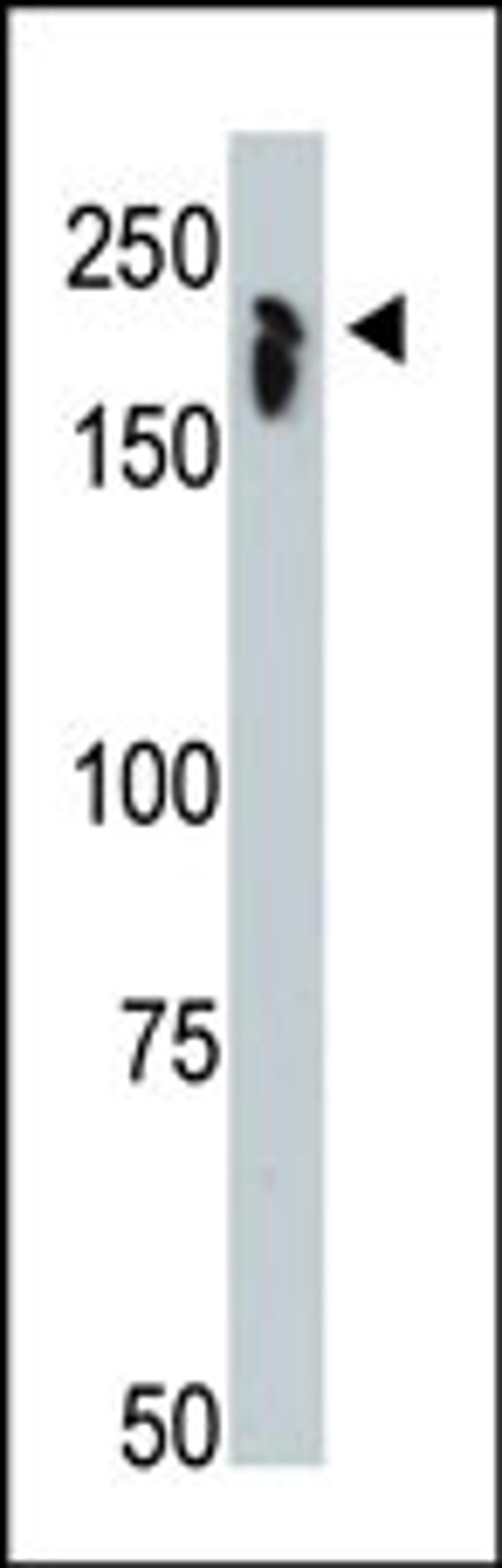 Antibody is used in Western blot to detect NCOR1 in mouse thymus tissue lysate.