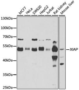 Western blot - XIAP antibody (A6869)