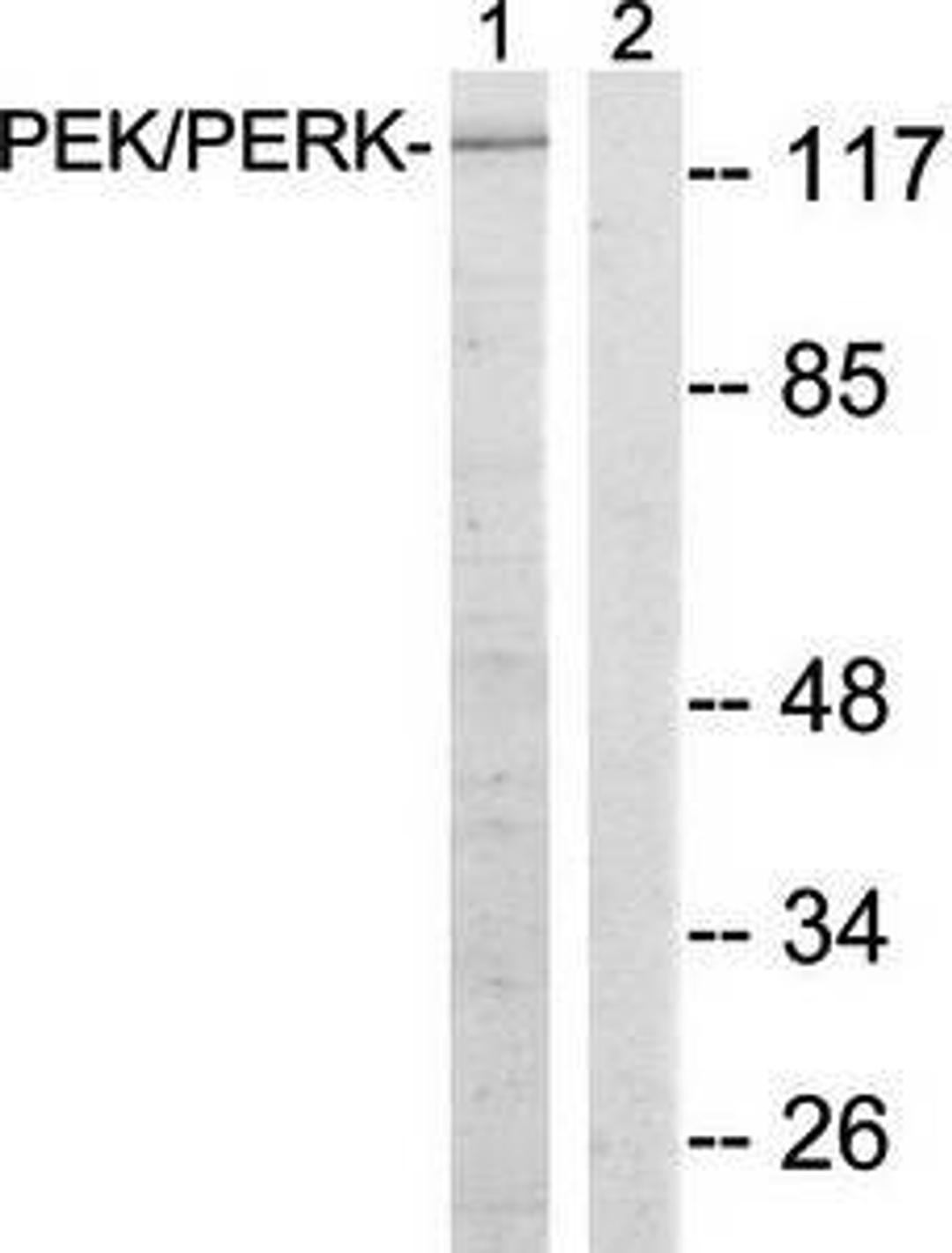 Western blot analysis of extracts from MCF-7 cells using PEK-PERK antibody