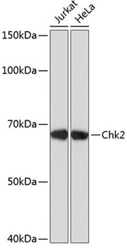 Western blot - Chk2 antibody (A19543)