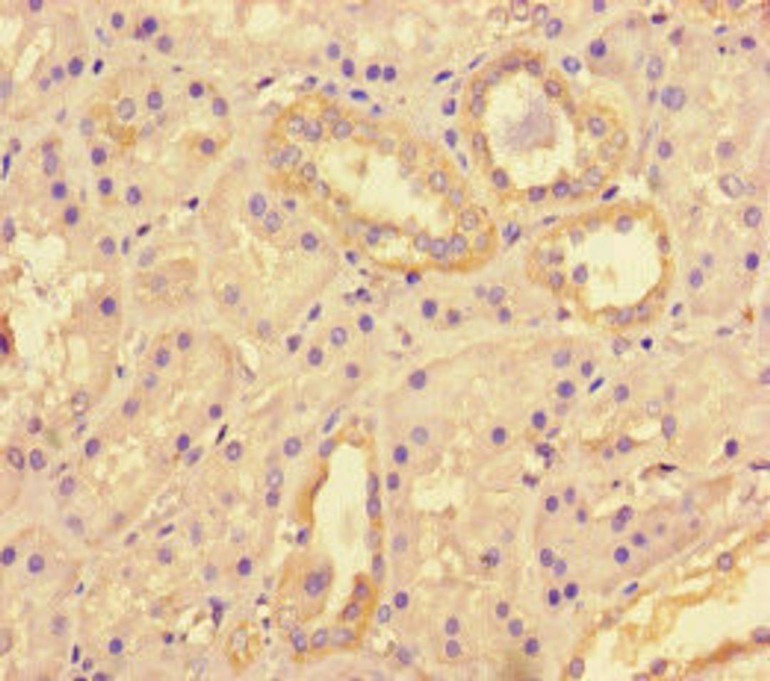 Immunohistochemistry of paraffin-embedded human kidney tissue using CSB-PA867136LA01HU at dilution of 1:100