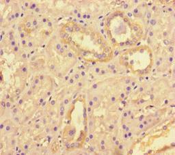 Immunohistochemistry of paraffin-embedded human kidney tissue using CSB-PA867136LA01HU at dilution of 1:100