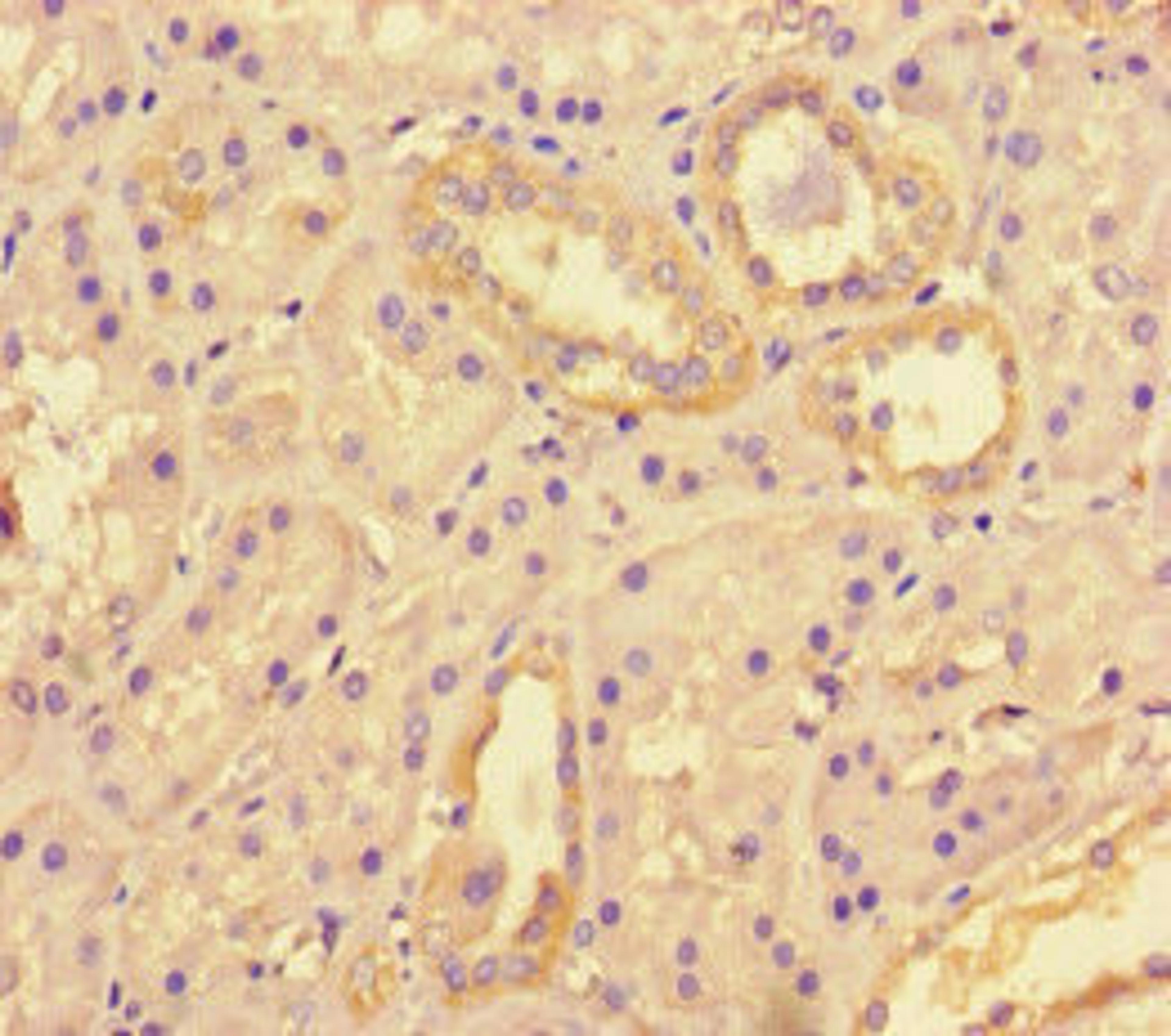 Immunohistochemistry of paraffin-embedded human kidney tissue using CSB-PA867136LA01HU at dilution of 1:100