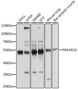 Western blot - PRKAR2A antibody (A1531)