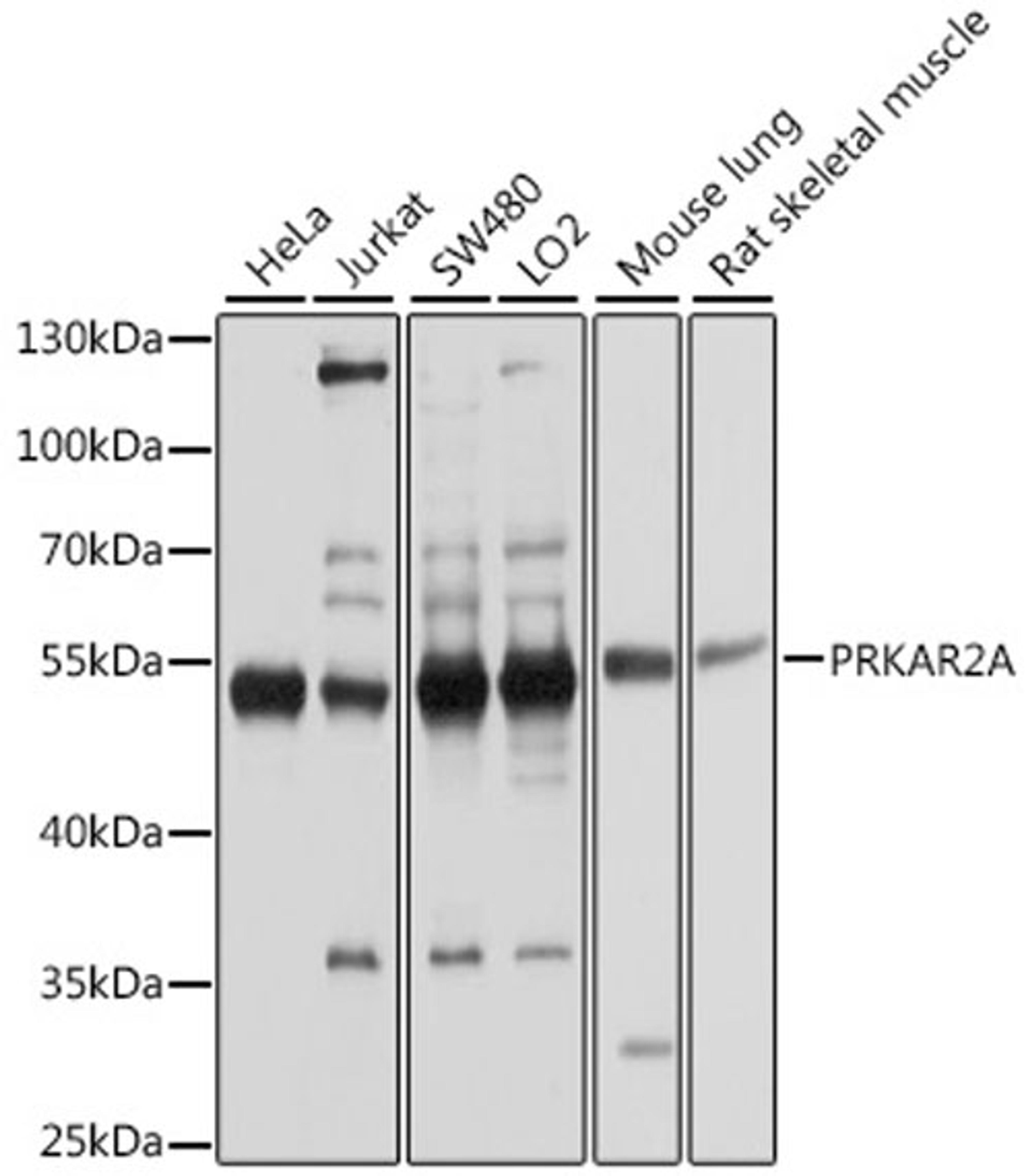 Western blot - PRKAR2A antibody (A1531)