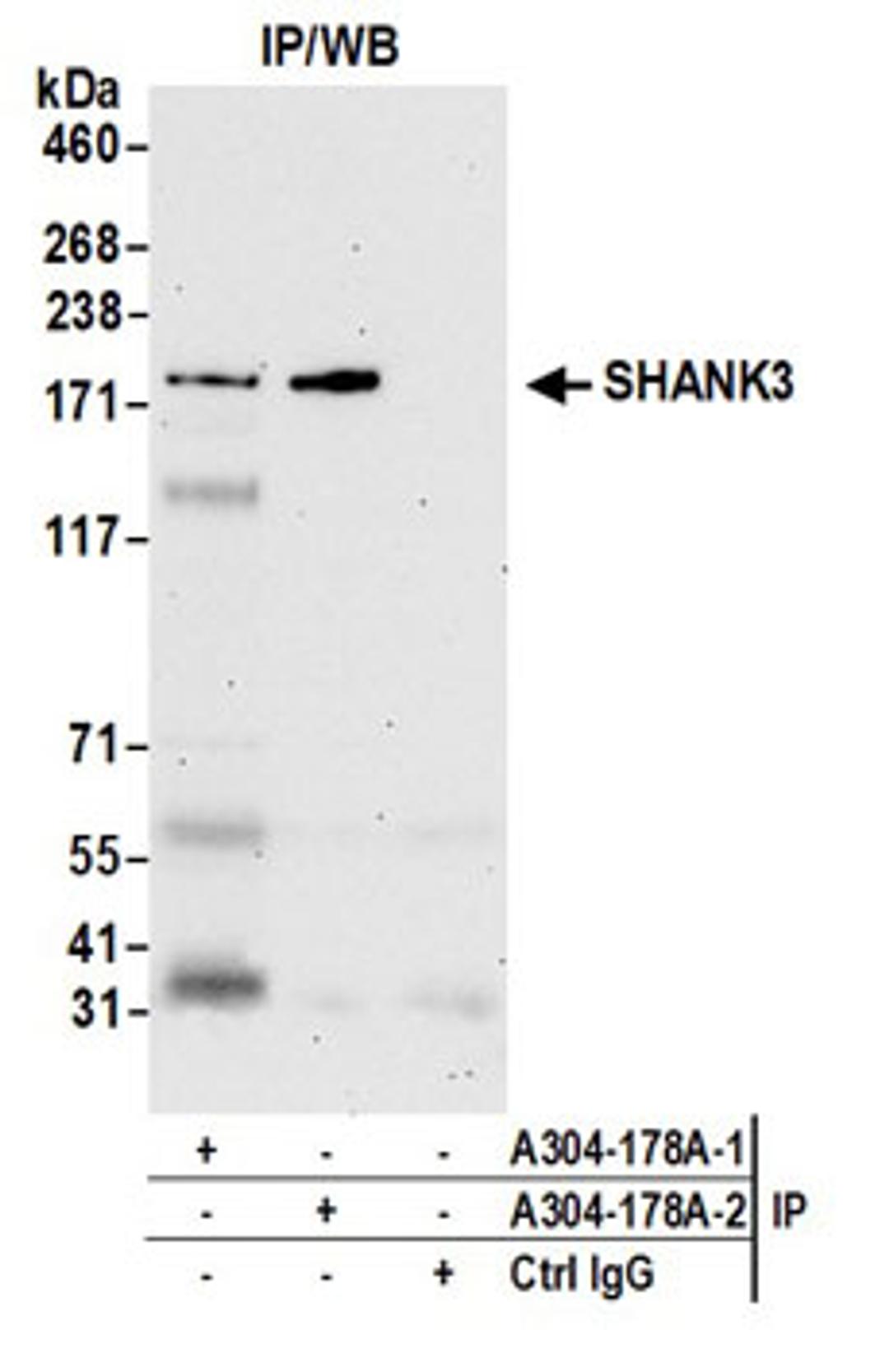 Detection of human SHANK3 by western blot of immunoprecipitates.