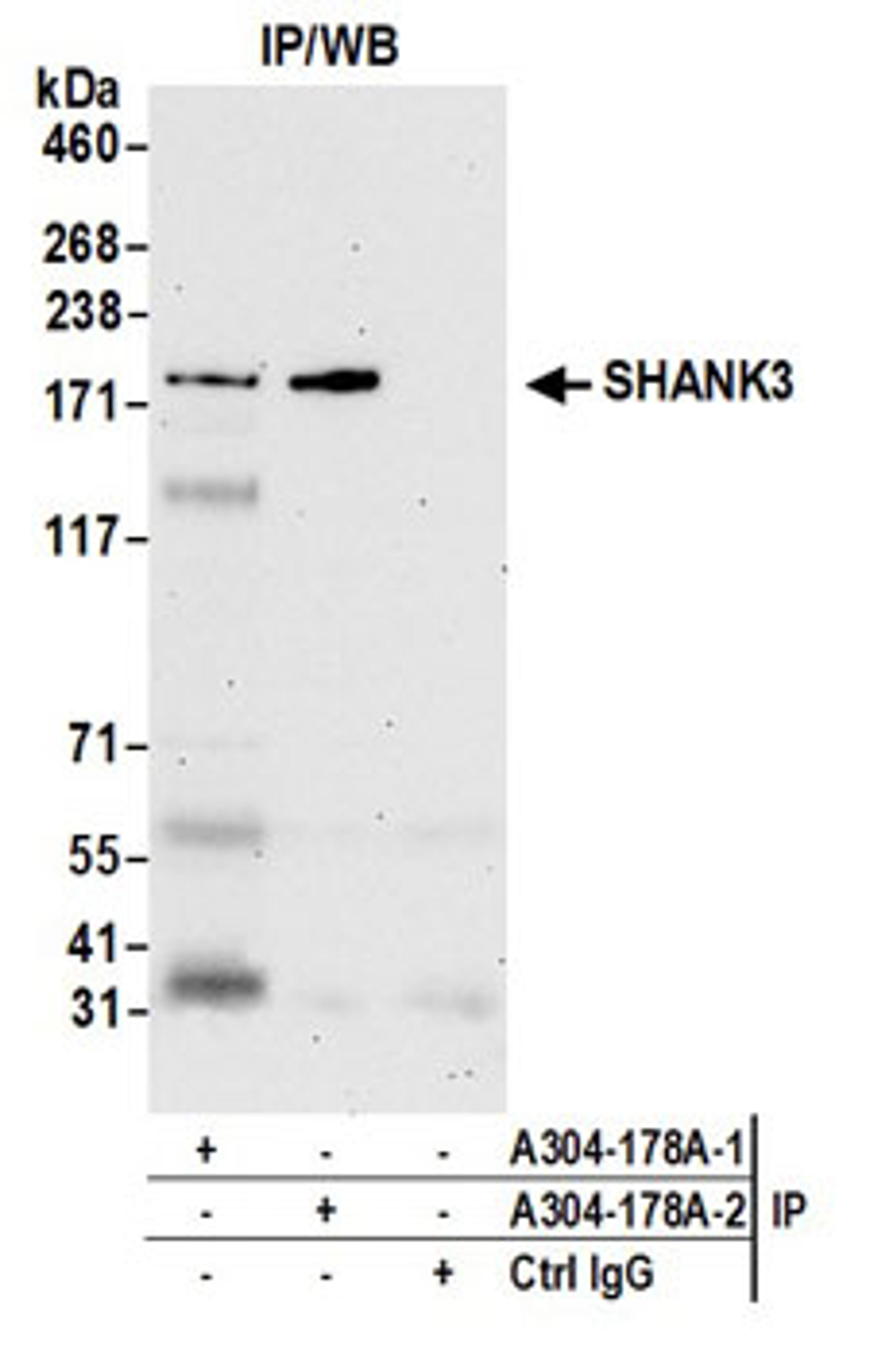 Detection of human SHANK3 by western blot of immunoprecipitates.