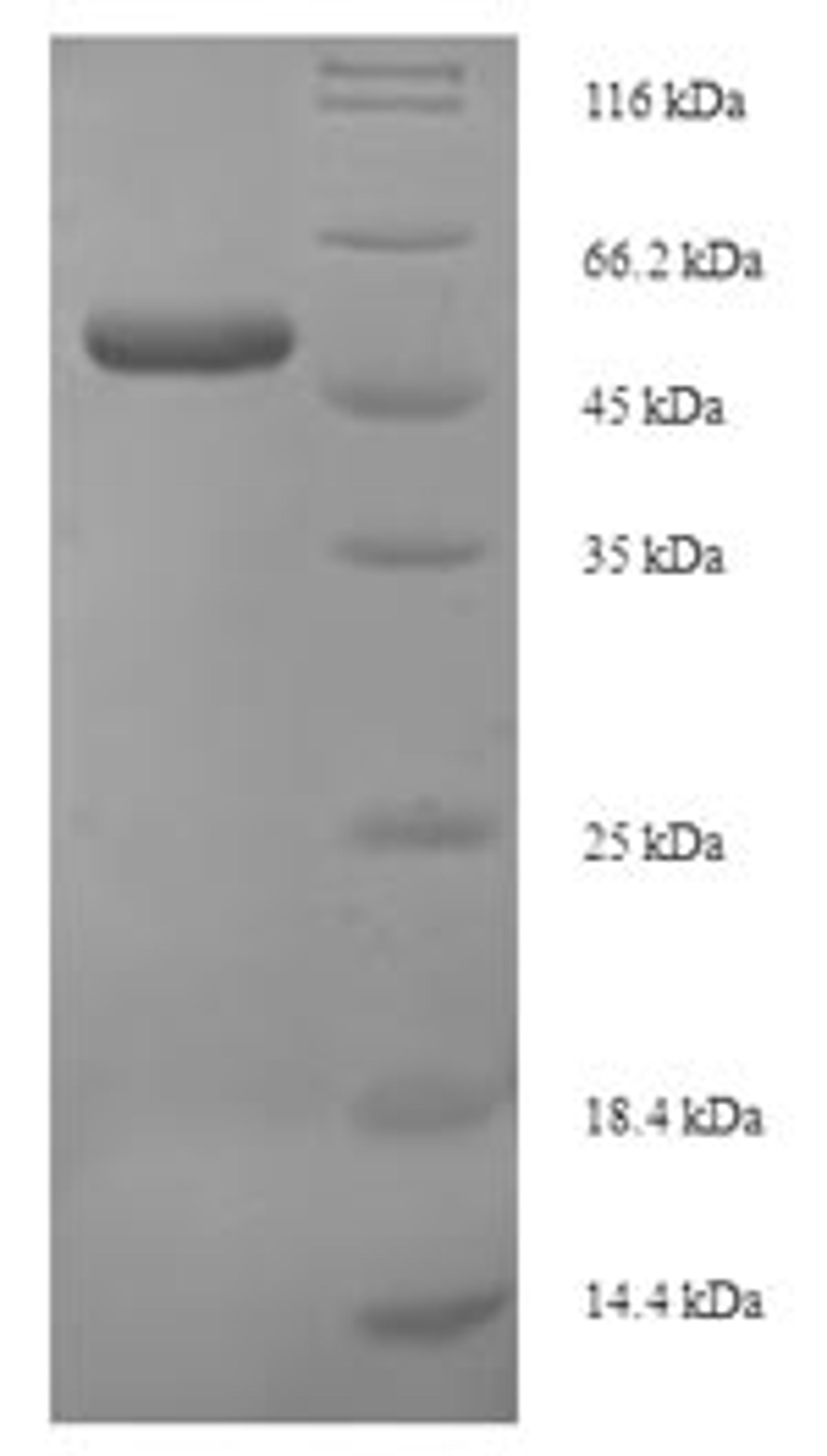 (Tris-Glycine gel) Discontinuous SDS-PAGE (reduced) with 5% enrichment gel and 15% separation gel.