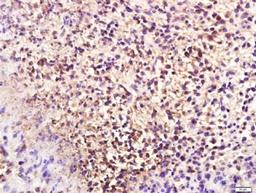 Immunohistochemical staining of Mouse mammary tumor Tissue using anti CSN1S2 antibody.