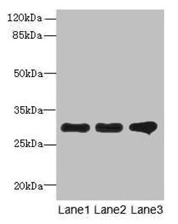 Western blot. All lanes: RMDN1 antibody at 0.6µg/ml. Lane 1: K562 whole cell lysate. Lane 2: HepG2 whole cell lysate. Lane 3: MCF-7 whole cell lysate. Secondary. Goat polyclonal to rabbit IgG at 1/10000 dilution. Predicted band size: 36, 33, 31 kDa. Observed band size: 31 kDa