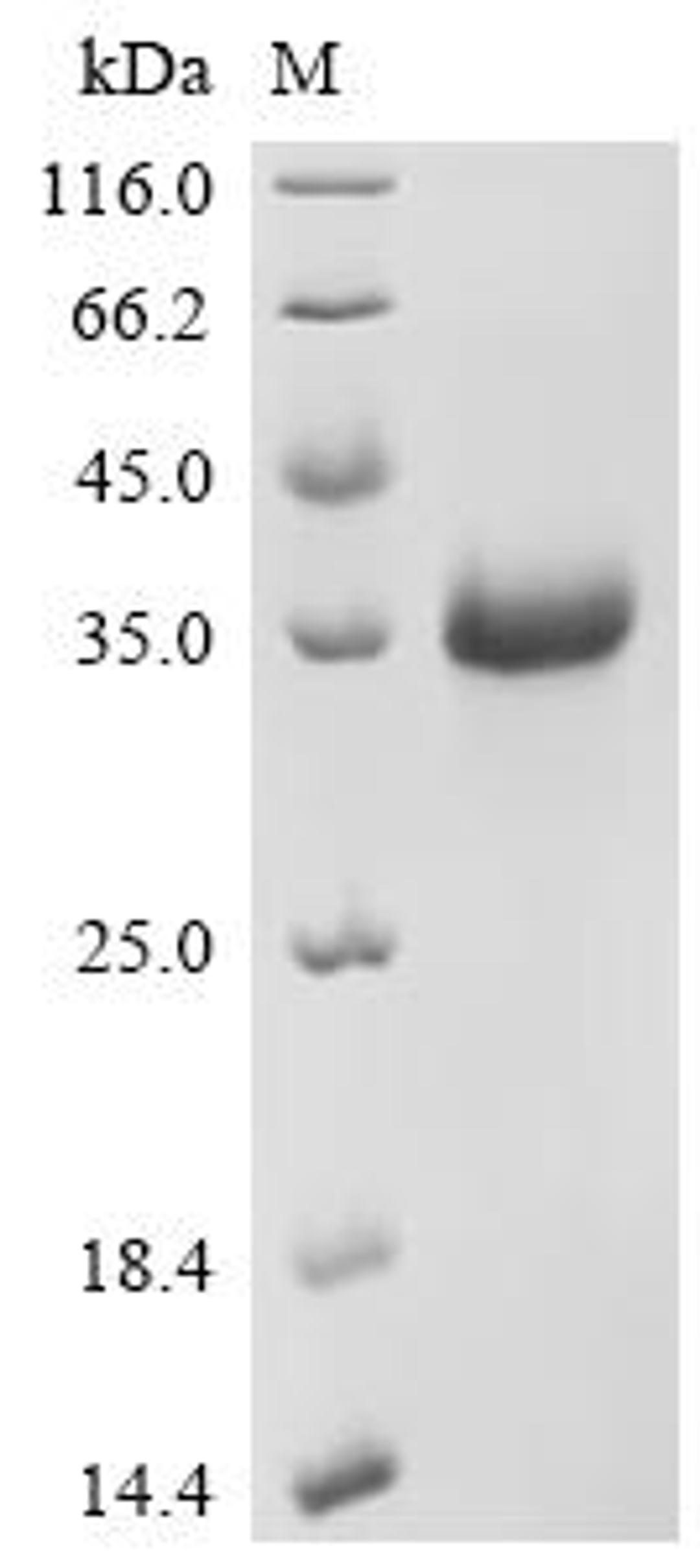 (Tris-Glycine gel) Discontinuous SDS-PAGE (reduced) with 5% enrichment gel and 15% separation gel.