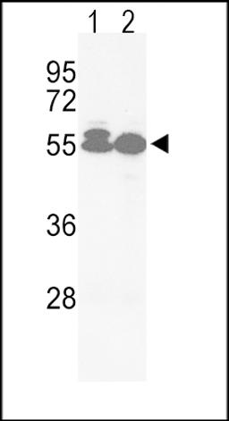 Western blot analysis of hACVRL1-L489 in Jurkat(lane 1), HepG2(lane 2) cell line lysates (35ug/lane)